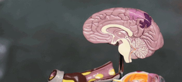 Абсцесс головного мозга