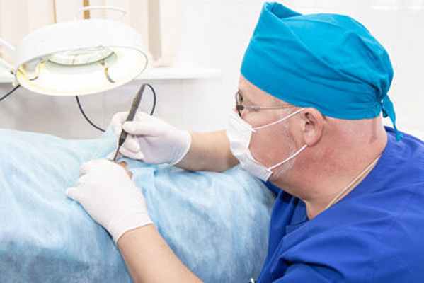 фото хирурга за работой