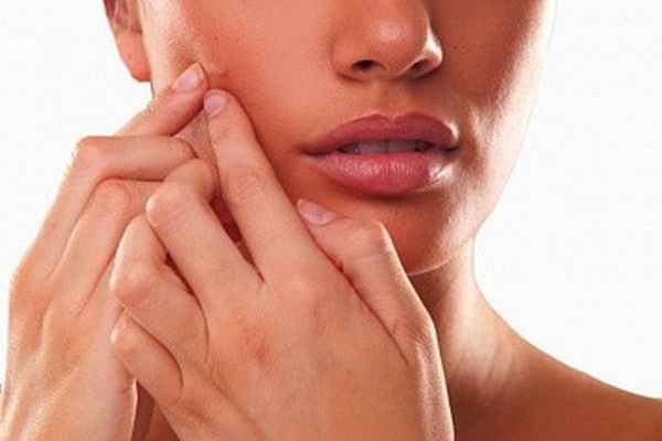 Фото Абсцесс кожи