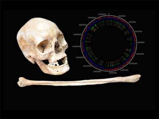 Кости одного из древнейших больных проказой