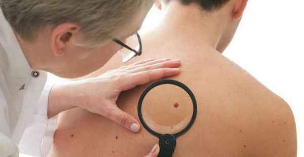 Предраковые заболевания: основные виды. Предраковые состояния