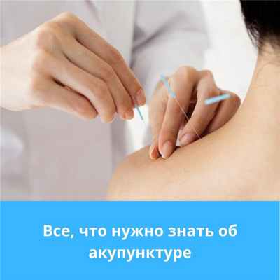 Все, что надо знать об акупунктуре