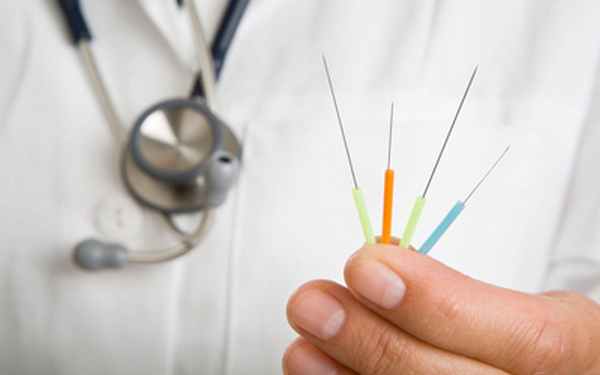 Разновидности иглорефлексотерапии - Угодие