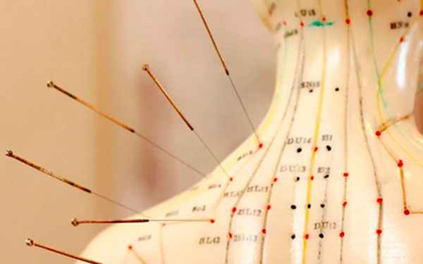 Круглые иглы в иглотерапии - Угодие