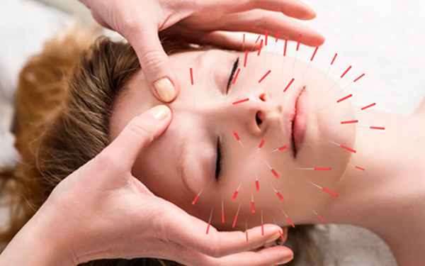 Сеанс иглорефлексотерапии - Угодие