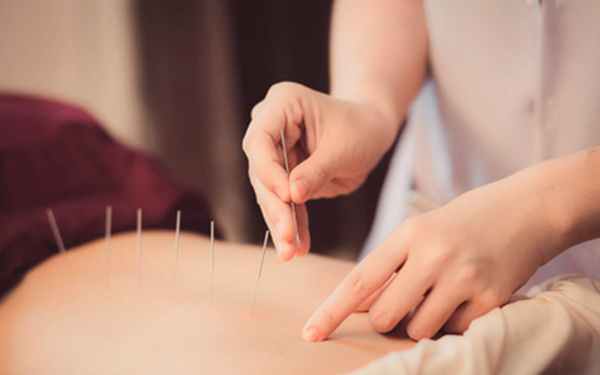 Иглорефлексотерапия - Угодие