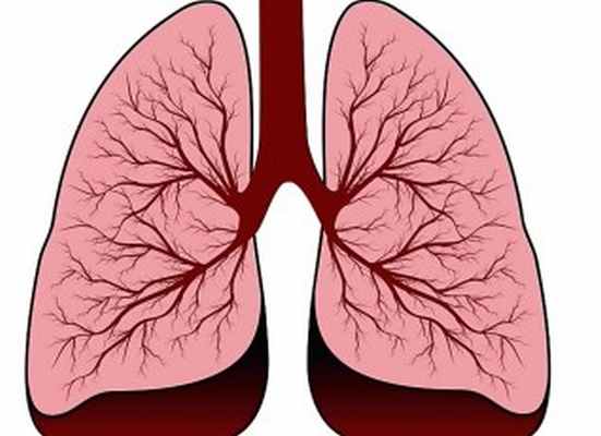 Лечение экзогенного аллергического альвеолита легких в Самаре