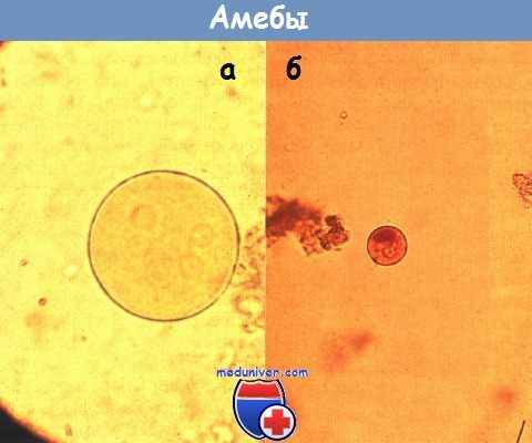 Амебы