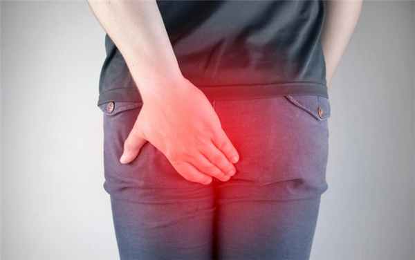 Анальный зуд