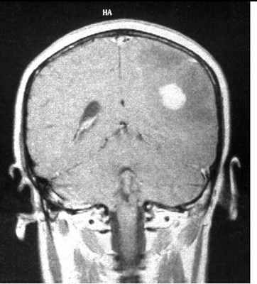 анапл астр-Т1-контр