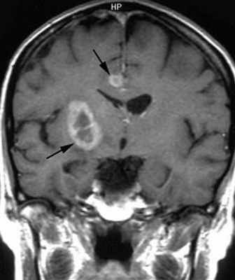 множ анапл аст