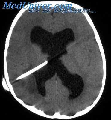 бодрствование и сознание