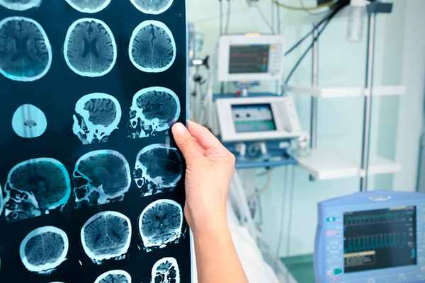 ЧТо такое мозг?