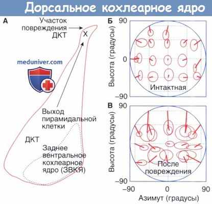 Дорсальное кохлеарное ядро (ДКЯ)