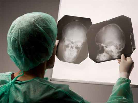 Клиновидная кость анатомия, строение внешней и внутренней поверхности, каналов и частей, форма и вид, функции крыловидных отростков