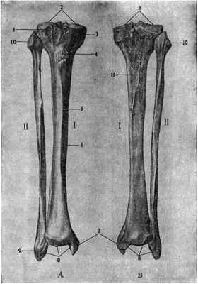 Кости голени (правой). А—спереди; Б — сзади; / — большеберцовая кость; II — малоберцовая кость