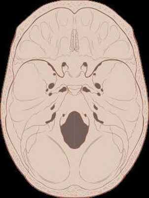 Наружное и внутреннее основание черепа. Черепные ямки внутреннего основания черепа
