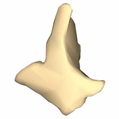 Скуловая кость. Височный отросток скуловой кости