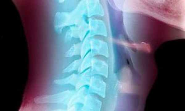 большой рог подъязычной кости 