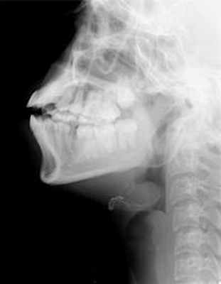 мышцы подъязычной кости 