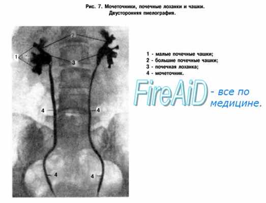 Рентгеноанатомия почки.