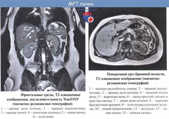 Анатомия: Лучевая анатомия почки (рентгенанатомия почки)