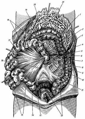 Рис. 116. Кишечник. 1 - брыжейка поперечной ободочной кишки; 2 - двенадцатиперстно-тощий изгиб; 3 - корень брыжейки поперечной ободочной кишки; 4 - диафрагмально-ободочная связка; 5 - левый изгиб ободочной кишки; 6,8 - двенадцатиперстно-тощая складка; 7 - верхнее двенадцатиперстное углубление; 9 - нисходящая ободочная кишка; 10 - париетальная брюшина в левом брыжеечном синусе; 11 - брыжейка сигмовидной ободочной кишки; 12 - сигмовидная ободочная кишка; 13 - червеобразный отросток; 14 - слепая кишка; 15 - подвздошная кишка; 16 - корень брыжейки тонкой кишки; 17 - брыжейка тонкой кишки; 18 - тощая кишка; 19 - tenia libera; 20 - поперечная ободочная кишка; 21 - большой сальник