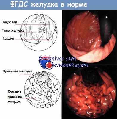 ФГДС желудка в норме