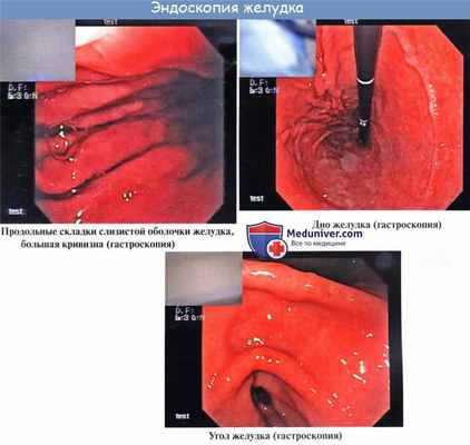 Анатомия : Желудок. Топография желудка