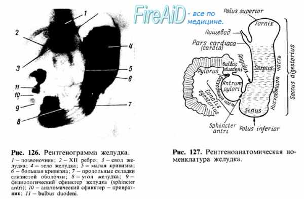 Рентгеноанатомия желудка.