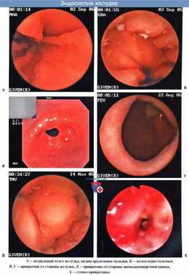 Анатомия : Желудок. Топография желудка