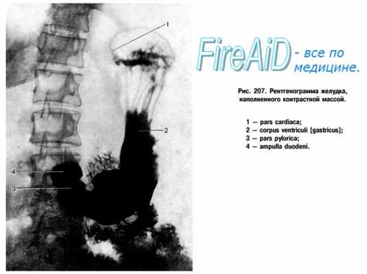 Рентгеноанатомия желудка.