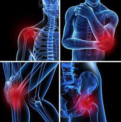 Симптомы проявления бурсита тазобедренного сустава, методы диагностики, терапия народными средствами, медикаментозное терапия, фото