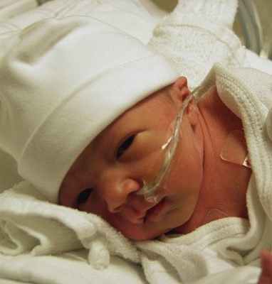 Фото Анемия у грудного ребенка