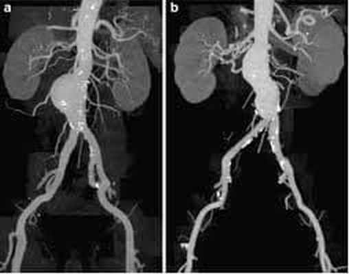 Рентгенография 2.jpg