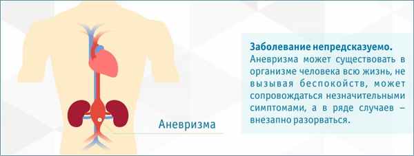 Аневризма брюшной аорты