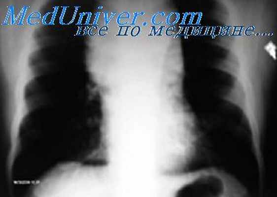 патология средостения