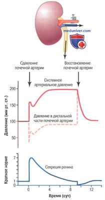 Ангиотензиновые гипертензии. Гипертензия Гольдблата