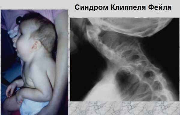 Симптомы фейля