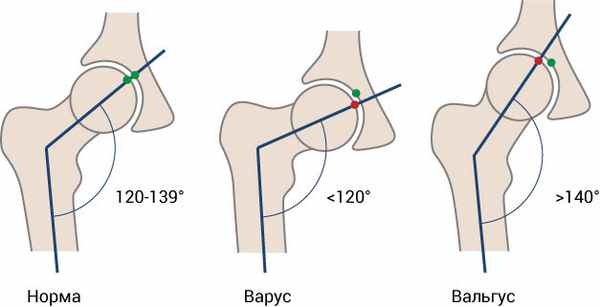 Тазобедренный сустав, рисунок