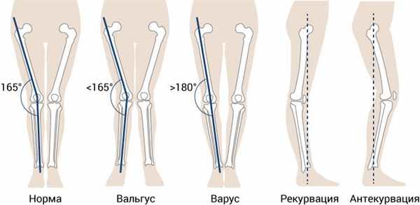 Положение коленного сустава, рисунок