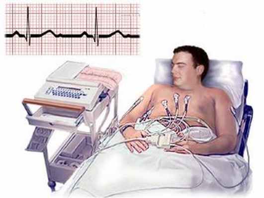 Электрокардиограмма