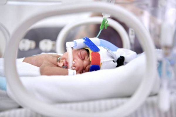 Апноэ недоношенных