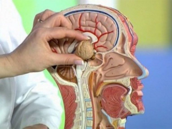 Апоплексия гипофиза