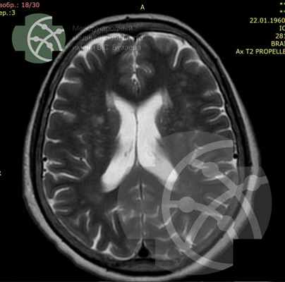 МРТ головного мозга в Уфе