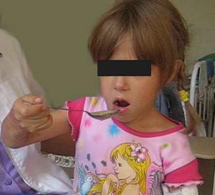 turner.ru артрогрипоз