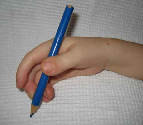 turner.ru артрогрипоз