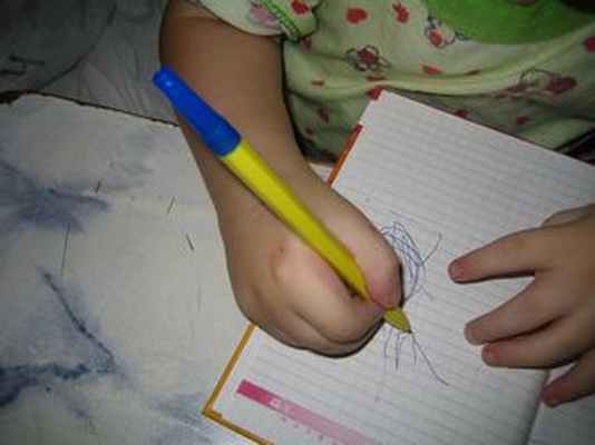 turner.ru артрогрипоз