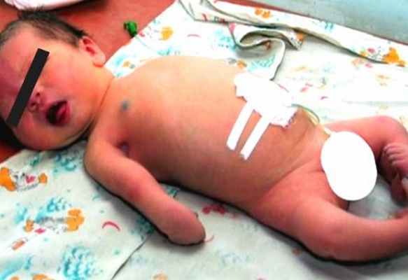 turner.ru артрогрипоз