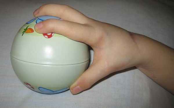 turner.ru артрогрипоз